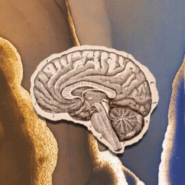 An etched drawing of the right side of the brain on a gold and blue background. Learn about FTD in this episode.