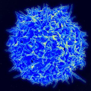 An electron microscope image of a human T-Cell