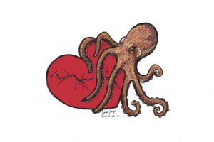 An octopus cradling a broken heart. We talk about Takotsubo cardiomyopathy - named for a Japanese octopus trap - in this episode. https://every1dies.org