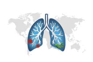 A lung against a backdrop of the globe. The base of the lung has representative microbes that cause pneumonia, such as viruses and pneumococcus. Learn all about pneumonia in this episode.