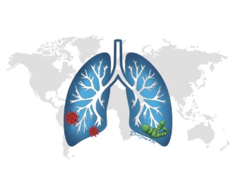 A lung against a backdrop of the globe. The base of the lung has representative microbes that cause pneumonia, such as viruses and pneumococcus. Learn all about pneumonia in this episode.