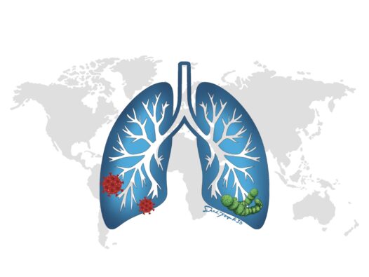 A lung against a backdrop of the globe. The base of the lung has representative microbes that cause pneumonia, such as viruses and pneumococcus. Learn all about pneumonia in this episode.
