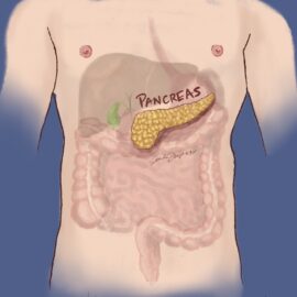 A medical image highlighting the position of the pancreas, surrounded by the liver, gall bladder stomach, spleen, and intestines. We talk about these internal organs being affected by and often removed in treatment of pancreatic cancer.
