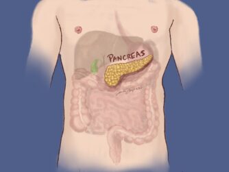 A medical image highlighting the position of the pancreas, surrounded by the liver, gall bladder stomach, spleen, and intestines. We talk about these internal organs being affected by and often removed in treatment of pancreatic cancer.