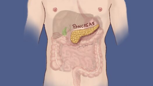 A medical image highlighting the position of the pancreas, surrounded by the liver, gall bladder stomach, spleen, and intestines. We talk about these internal organs being affected by and often removed in treatment of pancreatic cancer.