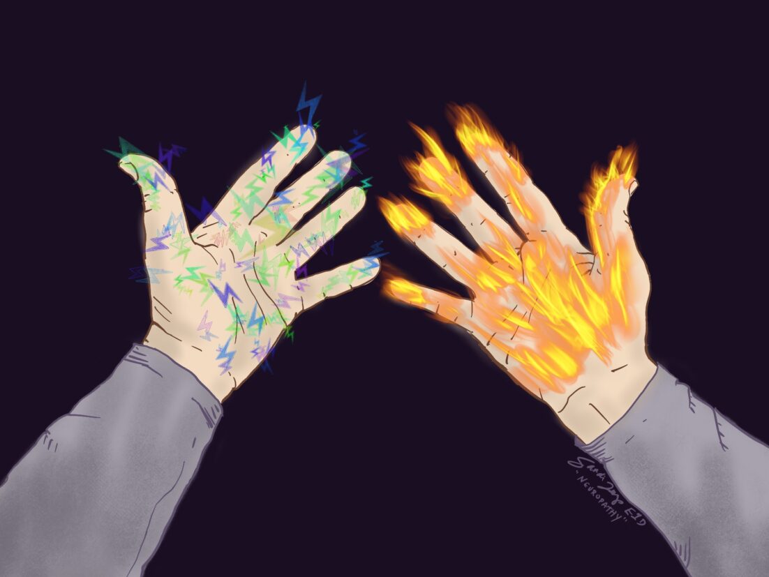 Digital art of hands with multi-colored lightning and orange flames representing the burning, tingling and electric pain of CIPN.