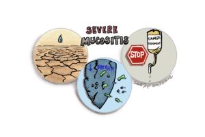 Some of the impacts of severe oral mucositis are dehydration, decreased barrier to infection leading to sepsis, and possible pause in cancer treatment, as shown with three different icons.